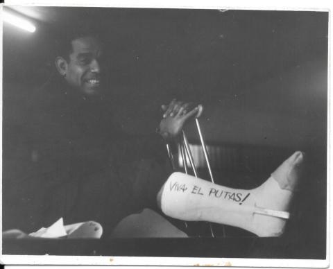 Manuel Zapata Olivella tras la fractura de la pierna derecha. La inscripción en el yeso refiere al personaje principal de su novela Changó, el gran putas publicada en 1983.